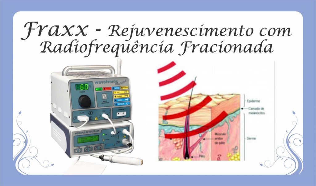 rejuvenescimento-íntimo-com-fraxx-aluguel