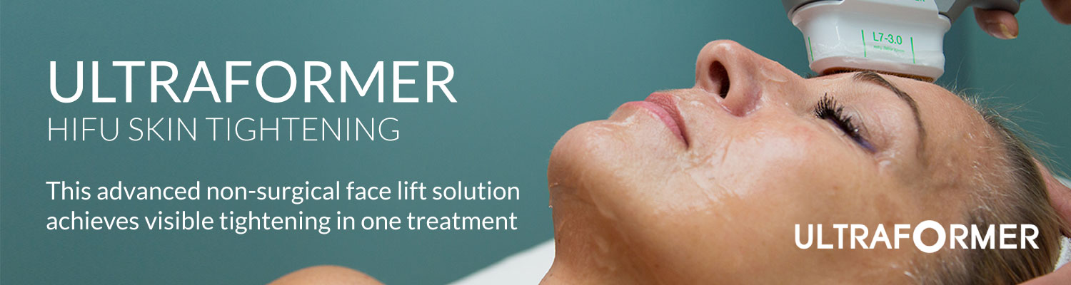 aluguel de ultraformer