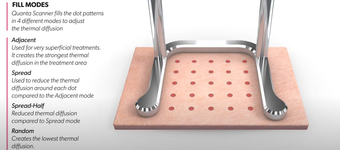 aluguel laser co2 aluguel laser co2