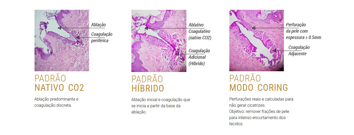 locacao de laser de co2 HIBRIDO locacao de laser de co2 HIBRIDO